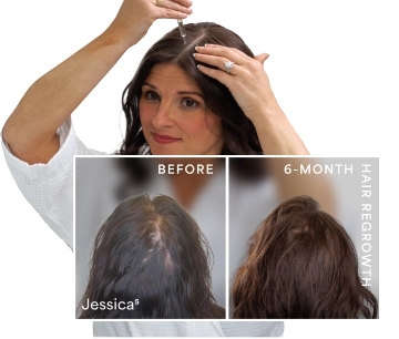 HairClub RX