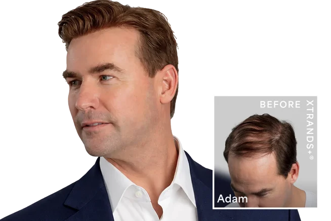 Xtrands+ hair system