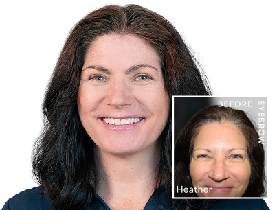 Cosmetic enhancement results