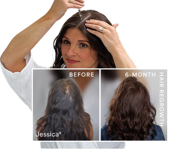 HairClub RX