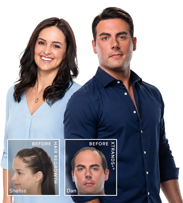 Bosley and HairClub clients